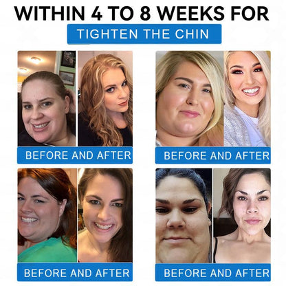 🔥Last Day 80% OFF🔥 ZVOEVO® SMGT-GLP-1 Tirzepatide & Collagen Nano Microneedle Weight Loss Patch | Targets Obesity, Loose Skin, High Blood Pressure, Diabetes, Fatty Liver, Joint Pain, Brain Fog, Low Energy, Body Aches, and More