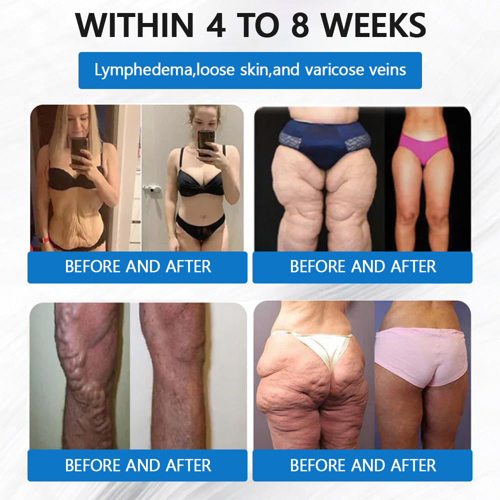 🔥Last Day 80% OFF🔥 ZVOEVO® SMGT-GLP-1 Tirzepatide & Collagen Nano Microneedle Weight Loss Patch | Targets Obesity, Loose Skin, High Blood Pressure, Diabetes, Fatty Liver, Joint Pain, Brain Fog, Low Energy, Body Aches, and More